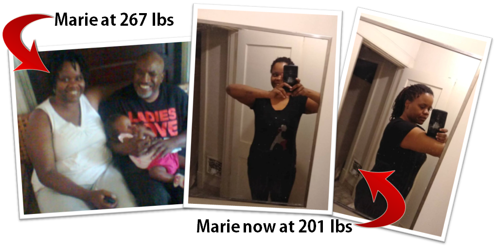 Marie-Before-After